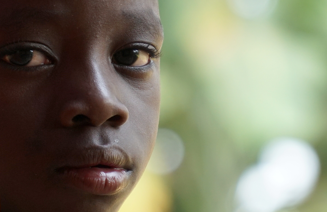 Afrika'da binlerce yetim ve muhtaç çocuk yaşıyor